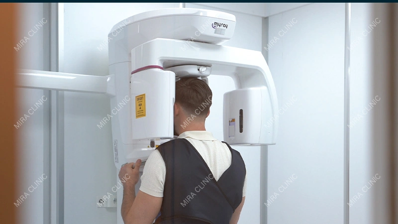 CBCT evaluation